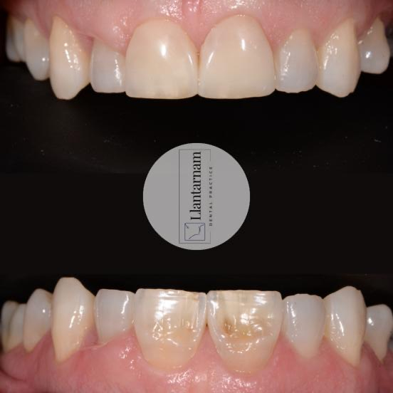 Llantarnam Dental Practice